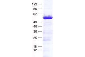 Validation with Western Blot (KIAA1456 Protein (KIAA1456) (His tag))