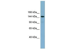 WB Suggested Anti-KIAA1199 Antibody Titration:  0. (CEMIP anticorps  (Middle Region))