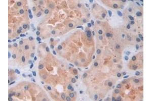Detection of ARRb1 in Human Kidney Tissue using Polyclonal Antibody to Arrestin Beta 1 (ARRb1)