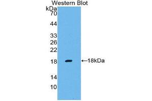 Western Blotting (WB) image for anti-Matrix Metallopeptidase 3 (Stromelysin 1, Progelatinase) (MMP3) (AA 247-370) antibody (ABIN1859855) (MMP3 anticorps  (AA 247-370))