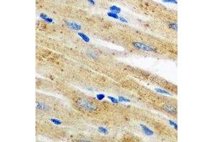 Immunohistochemical analysis of AKR7A2 staining in mouse heart formalin fixed paraffin embedded tissue section. (AKR7A2 anticorps)