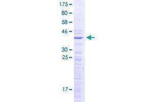Image no. 1 for Small Nuclear Ribonucleoprotein D1 Polypeptide 16kDa (SNRPD1) (AA 1-119) protein (GST tag) (ABIN1989776)