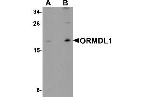 Western blot analysis of ORMDL1 in SK-N-SH Cell lysate with ORMDL1 antibody at (A) 1 µg/mL and (B) 2 µg/mL. (ORMDL1 anticorps)