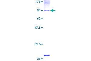 Image no. 1 for Aldehyde Dehydrogenase 1 Family, Member B1 (ALDH1B1) (AA 1-517) protein (GST tag) (ABIN1344820)