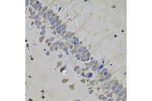 Immunohistochemistry of paraffin-embedded rat brain using NAA50 Antibody (ABIN5975518) at dilution of 1/100 (40x lens).