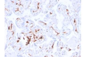 Formalin-fixed, paraffin-embedded human placenta stained with Factor 13A Recombinant Rabbit Monoclonal Antibody (F13A1/3772R).