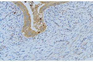 ABIN6268688 at 1/100 staining Human uterus tissue by IHC-P. (IL-4 anticorps  (Internal Region))