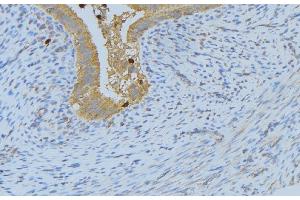 ABIN6268688 at 1/100 staining Human uterus tissue by IHC-P. (IL-4 anticorps  (Internal Region))