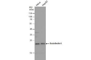 WB Image Endothelin 1 antibody detects Endothelin 1 protein by western blot analysis.