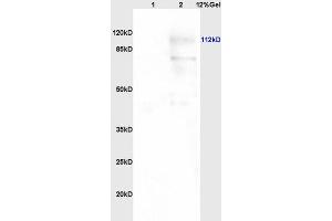 Lane 1: human colon carcinoma lysates Lane 2: rat brain lysates probed with Anti PARP (N-Terminus) Polyclonal Antibody, Unconjugated (ABIN677903) at 1:200 in 4 °C.