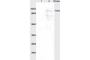 Lane 1: human colon carcinoma lysates Lane 2: rat brain lysates probed with Anti PARP (N-Terminus) Polyclonal Antibody, Unconjugated (ABIN677903) at 1:200 in 4 °C. (PARP1 anticorps  (AA 201-300))