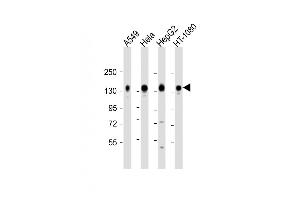 All lanes : Anti-C Antibody (C-term) at 1:2000 dilution Lane 1: A549 whole cell lysate Lane 2: Hela whole cell lysate Lane 3: HepG2 whole cell lysate Lane 4: HT-1080 whole cell lysate Lysates/proteins at 20 μg per lane.