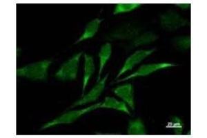 Immunostaining analysis in HeLa cells. (CARD8 anticorps)