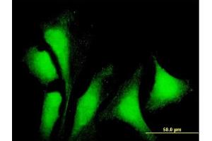 Immunofluorescence of purified MaxPab antibody to G3BP1 on HeLa cell.