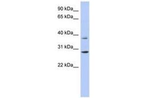 Image no. 1 for anti-Homeobox C5 (HOXC5) (C-Term) antibody (ABIN6742851) (Homeobox C5 anticorps  (C-Term))