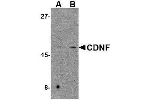 Western blot analysis of CDNF in mouse brain tissue lysate with AP30221PU-N CDNF antibody at (A) 2 and (B) 4 μg/ml. (CDNF anticorps  (C-Term))