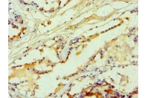 Immunohistochemistry of paraffin-embedded human prostate tissue using ABIN7142626 at dilution of 1:100 (Serotonin Receptor 2B anticorps  (AA 382-481))