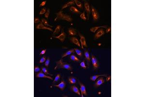 Immunofluorescence analysis of U-2 OS cells using MLPH antibody (ABIN6128273, ABIN6143892, ABIN6143893 and ABIN6222354) at dilution of 1:100. (Melanophilin anticorps  (AA 301-600))