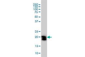 RHOA monoclonal antibody (M05), clone 1C1 Western Blot analysis of RHOA expression in HeLa .