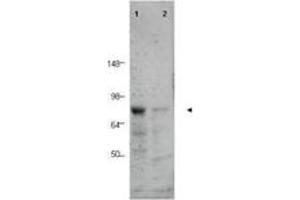 Image no. 1 for anti-CCCTC-Binding Factor (Zinc Finger Protein)-Like (CTCFL) (AA 9-26) antibody (ABIN199968) (CTCFL anticorps  (AA 9-26))