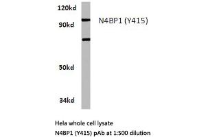 Western blot (WB) analysis of N4BP1 antibody in extracts from Hela cells. (N4BP1 anticorps)