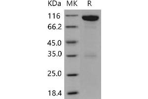 Western Blotting (WB) image for EPH Receptor A6 (Epha6) (Active) protein (Fc Tag) (ABIN7195532)