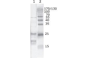 Western Blot testing of HIV-1 recombinant Tat protein. (HIV-1 Tat anticorps  (AA 2-9))