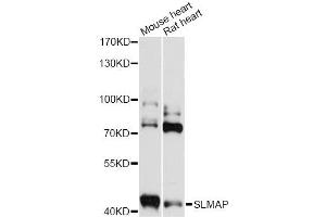 Western blot analysis of extracts of various cell lines, using SLMAP antibody (ABIN6293579) at 1:3000 dilution.