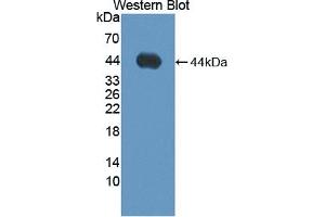 Detection of Recombinant ADAMTS19, Human using Polyclonal Antibody to A Disintegrin And Metalloproteinase With Thrombospondin 19 (ADAMTS19) (ADAMTS19 anticorps  (AA 325-686))