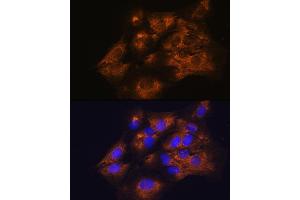 Immunofluorescence analysis of C6 cells using SERPING1 antibody ( ABIN3022429, ABIN3022430, ABIN3022431 and ABIN6218816) at dilution of 1:100.
