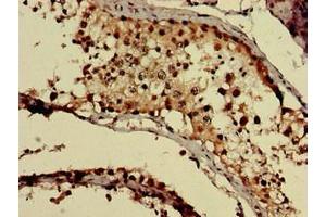 Immunohistochemistry of paraffin-embedded human testis tissue using ABIN7154703 at dilution of 1:100 (GNAQ anticorps  (AA 1-359))