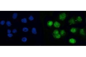 IF analysis of BRCC36/BRCC3 using anti-BRCC36/BRCC3 antibody (ABIN7599595). (BRCC3 anticorps  (AA 10-276))