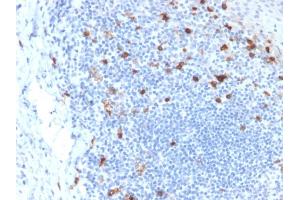 Formalin-fixed, paraffin-embedded human Tonsil stained with CD103 Mouse Monoclonal Antibody (ITGAE/2063).