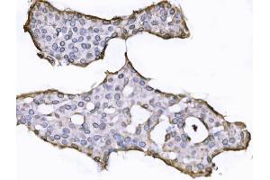 IHC analysis of SUN2 using anti-SUN2 antibody (ABIN7601278). (SUN2 anticorps  (AA 31-695))