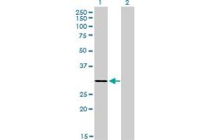 Western Blot analysis of LDB3 expression in transfected 293T cell line by LDB3 monoclonal antibody (M06A), clone 3C8. (LIM Domain Binding 3 Protein anticorps  (AA 1-283))