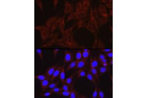 Immunofluorescence analysis of NIH/3T3 cells using PIK3C3/VPS34 Rabbit pAb (ABIN6134410, ABIN6145632, ABIN6145634 and ABIN6216127) at dilution of 1:50 (40x lens). (PIK3C3 anticorps  (AA 150-250))