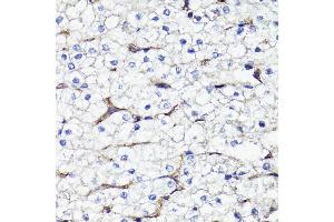 Immunohistochemistry of paraffin-embedded human liver using CD44 antibody (ABIN7266201) at dilution of 1:100 (40x lens). (CD44 anticorps  (AA 346-385))