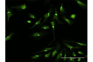 Immunofluorescence of purified MaxPab antibody to PDXDC1 on HeLa cell. (PDXDC1 anticorps  (AA 1-788))