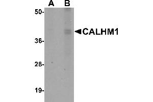 Western Blotting (WB) image for anti-Calcium Homeostasis Modulator 1 (CALHM1) (N-Term) antibody (ABIN1031289)