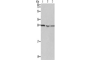 Western Blotting (WB) image for anti-Proteasome (Prosome, Macropain) 26S Subunit, Non-ATPase, 9 (PSMD9) antibody (ABIN2428649) (PSMD9 anticorps)