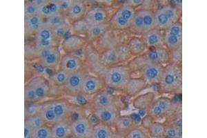 IHC-P analysis of Mouse Tissue, with DAB staining. (Dystrophin anticorps  (AA 3059-3314))