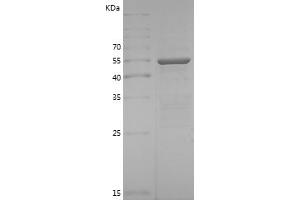 Western Blotting (WB) image for TNF Receptor-Associated Factor 3 (TRAF3) (AA 323-565) protein (GST tag) (ABIN7125408) (TRAF3 Protein (AA 323-565) (GST tag))