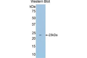 WB of Protein Standard: different control antibodies against Highly purified E. (SUOX Kit ELISA)
