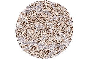 anti-Tumor Protein P53 Binding Protein 1 (TP53BP1) (C-Term) antibody