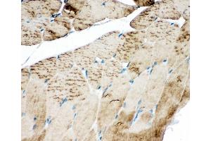 Anti-SERCA1 ATPase antibody, IHC(P) IHC(P): Rat Skeletal Muscle Tissue