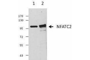 Western Blotting (WB) image for anti-Nuclear Factor of Activated T-Cells, Cytoplasmic, Calcineurin-Dependent 2 (NFAT1) antibody (ABIN2665286) (NFAT1 anticorps)