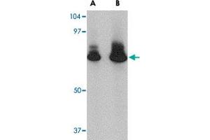 Western blot analysis of ATG16L1 in HeLa cell lysate with ATG16L1 polyclonal antibody  at (A) 1 and (B) 2 ug/mL . (ATG16L1 anticorps  (N-Term))
