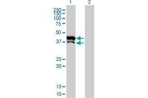 Western Blot analysis of GPD2 expression in transfected 293T cell line by GPD2 monoclonal antibody (M02), clone 2C11-1F4. (GPD2 anticorps  (AA 1-378))