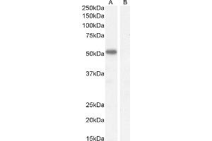 (ABIN570827) (1 μg/mL) staining of Mouse Heart lysate (35 μg protein in RIPA buffer).
