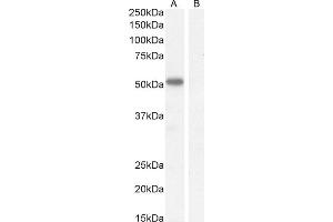 (ABIN570827) (1 μg/mL) staining of Mouse Heart lysate (35 μg protein in RIPA buffer). (IKZF4 anticorps  (Internal Region))
